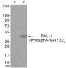 Western blot analysis of extracts from JK cells (Lane 2) , using TAL-1 (Phospho-Ser122) Antibody. The lane on the left is treated with antigen-specific peptide.