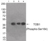 Western blot analysis of extracts from HeLa cells (Lane 2) , A549 cells (Lane 3) and HepG2 cells (Lane 4) , using TOB1 (Phospho-Ser164) Antibody. The lane on the left is treated with antigen-specific peptide.