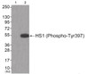 Western blot analysis of extracts from JK cells (Lane 2) , using HS1 (Phospho-Tyr397) Antibody. The lane on the left is treated with antigen-specific peptide.