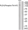 Western blot analysis of extracts from HepG2 cells using PLD1 (Phospho-Thr147) Antibody. The lane on the right is treated with the antigen-specific peptide.