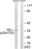 Western blot analysis of extracts from HepG2 cells treated with PMA using YB1 (Phospho-Ser102) Antibody. The lane on the right is treated with the antigen-specific peptide.
