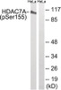 Western blot analysis of extracts from HeLa cells using HDAC7A (Phospho-Ser155) Antibody. The lane on the right is treated with the antigen-specific peptide.