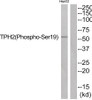 Western blot analysis of extracts from HepG2 cells using TPH2 (Phospho-Ser19) Antibody. The lane on the right is treated with the antigen-specific peptide.