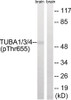 Western blot analysis of extracts from Rat brain cells using TUBA1/3/4 (Phospho-Tyr272) Antibody. The lane on the right is treated with the antigen-specific peptide.