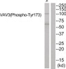 Western blot analysis of extracts from JK cells using VAV3 (Phospho-Tyr173) Antibody. The lane on the right is treated with the antigen-specific peptide.
