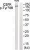 Western blot analysis of extracts from HepG2 cells using CSFR (Phospho-Tyr708) Antibody. The lane on the right is treated with the antigen-specific peptide.