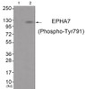 Western blot analysis of extracts from JK cells (Lane 2) , using EPHA7 (Phospho-Tyr791) Antibody. The lane on the left is treated with antigen-specific peptide.
