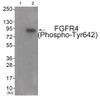 Western blot analysis of extracts from JK cells (Lane 2) , using FGFR4 (Phospho-Tyr642) Antibody. The lane on the left is treated with antigen-specific peptide.