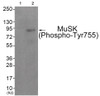 Western blot analysis of extracts from JK cells (Lane 2) , using MuSK (Phospho-Tyr755) Antibody. The lane on the left is treated with antigen-specific peptide.