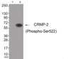 Western blot analysis of extracts from HuvEc cells (Lane 2) , using CRMP-2 (Phospho-Ser522) Antibody. The lane on the left is treated with antigen-specific peptide.