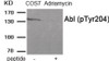 Western blot analysis of extracts from COS7 cells treated with Adriamycin using Abl (Phospho-Tyr204) Antibody. The lane on the right is treated with the antigen-specific peptide.