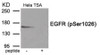 Western blot analysis of extracts from HeLa cells treated with TSA using Phospho-EGFR (Ser1026) Antibody. The lane on the right is treated with the antigen-specific peptide.
