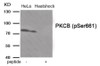 Western blot analysis of extracts from HeLa cells treated with Heatshock using Phospho-PKCB (Ser661) Antibody. The lane on the right is treated with the antigen-specific peptide.