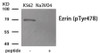 Western blot analysis of extracts from K562 cells treated with Na3VO4 using Phospho-Ezrin (Tyr478) Antibody. The lane on the right is treated with the antigen-specific peptide.