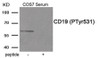 Western blot analysis of extracts from COS7 cells treated with Serum using Phospho-CD19 (Tyr531) Antibody. The lane on the right is treated with the antigen-specific peptide.