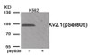 Western blot analysis of extracts from K562 cells treated with TNF using Phospho-Kv2.1 (Ser805) Antibody. The lane on the right is treated with the antigen-specific peptide.