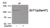 Western blot analysis of extracts from JK tissue using SirT1 (Phospho-Ser47) Antibody. The lane on the right is treated with the antigen-specific peptide.