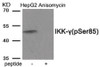 Western blot analysis of extracts from HepG2 cells treated with Anisomycin using Phospho-IKK-gamma (Ser85) Antibody. The lane on the right is treated with the antigen-specific peptide.