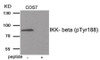 Western blot analysis of extracts from COS7 tissue using IKK- beta (Phospho-Tyr188) Antibody. The lane on the right is treated with the antigen-specific peptide.