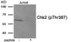 Western blot analysis of extracts from Jurkat tissue using Chk2 (Phospho-Thr387) Antibody. The lane on the right is treated with the antigen-specific peptide.