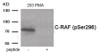 Western blot analysis of extracts from 293 cells treated with PMA using Phospho-C-RAF (Ser296) Antibody. The lane on the right is treated with the antigen-specific peptide.