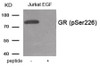 Western blot analysis of extracts from Jurkat cells treated with EGF using Phospho-GR (Ser226) Antibody. The lane on the right is treated with the antigen-specific peptide.