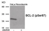Western blot analysis of extracts from HeLa cells treated with Nocodazole using Phospho-BCL-2 (Ser87) Antibody. The lane on the right is treated with the antigen-specific peptide.