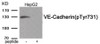 Western blot analysis of extracts from HepG2 cells treated with Na3VO4 using Phospho-VE-Cadherin (Tyr731) Antibody. The lane on the right is treated with the antigen-specific peptide.