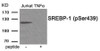 Western blot analysis of extracts from Jurkat cells treated with TNF using Phospho-SREBP-1 (Ser439) Antibody. The lane on the right is treated with the antigen-specific peptide.