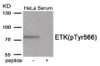 Western blot analysis of extracts from HeLa cells treated with Serum using Phospho-ETK (Tyr566) Antibody. The lane on the right is treated with the antigen-specific peptide.