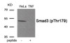 Western blot analysis of extracts from HeLa cells treated with TNF using Phospho-Smad3 (Thr179) Antibody. The lane on the right is treated with the antigen-specific peptide.