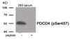 Western blot analysis of extracts from 293 cells treated with Serum using Phospho-PDCD4 (Ser457) Antibody. The lane on the right is treated with the antigen-specific peptide.