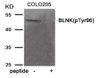 Western blot analysis of extracts from COLO205 tissue using BLNK (Phospho-Tyr96) Antibody. The lane on the right is treated with the antigen-specific peptide.
