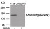 Western blot analysis of extracts from HT29 cells treated with CalyculinA using Phospho-FANCD2 (Ser222) Antibody. The lane on the right is treated with the antigen-specific peptide.