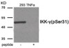 Western blot analysis of extracts from 293 cells treated with TNF-a using Phospho-IKK- gamma (Ser31) Antibody. The lane on the right is treated with the antigen-specific peptide.