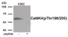 Western blot analysis of extracts from K562 cells treated with H2O2 using Phospho-CaMK4 (Thr196/200) Antibody. The lane on the right is treated with the antigen-specific peptide.