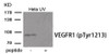 Western blot analysis of extracts from HeLa cells treated with UV using Phospho-VEGFR1 (Tyr1213) Antibody. The lane on the right is treated with the antigen-specific peptide.