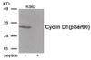 Western blot analysis of extracts from K562 tissue using Cyclin D1 (Phospho-Ser90) Antibody. The lane on the right is treated with the antigen-specific peptide.