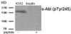 Western blot analysis of extracts from c-Abl Insulin treated K562 tissue using Antibody. The lane on the right is treated with the antigen-specific peptide.