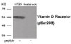 Western blot analysis of extracts from HT29 cells treated with Heatshock using Phospho-Vitamin D Receptor (Ser208) Antibody. The lane on the right is treated with the antigen-specific peptide.