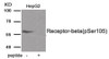 Western blot analysis of extracts from HepG2 tissue using Estrogen Receptor- beta (Phospho-Ser105) Antibody. The lane on the right is treated with the antigen-specific peptide.