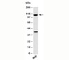 Western blot testing of human samples with TLR9 antibody at 2ug/ml.