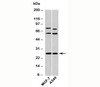 Western blot testing of human samples with Syndecan 4 antibody at 2ug/ml.
