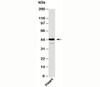 Western blot testing of human samples with Als2Cr2 antibody at 6ug/ml.