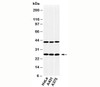 Western blot testing of human samples with CLEC4E antibody at 2ug/ml.