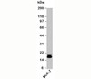 Western blot testing of human samples with Survivin antibody at 2ug/ml.