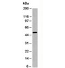 Western blot testing of human samples with SGK1 antibody at 1ug/ml.