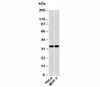 Western blot testing of human samples with EMAP II antibody at 2ug/ml.