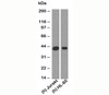 Western blot testing of human samples with RUNX3 antibody at 2 ug/ml.