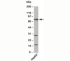 Western blot testing of human samples with TAB3 antibody at 4ug/ml.